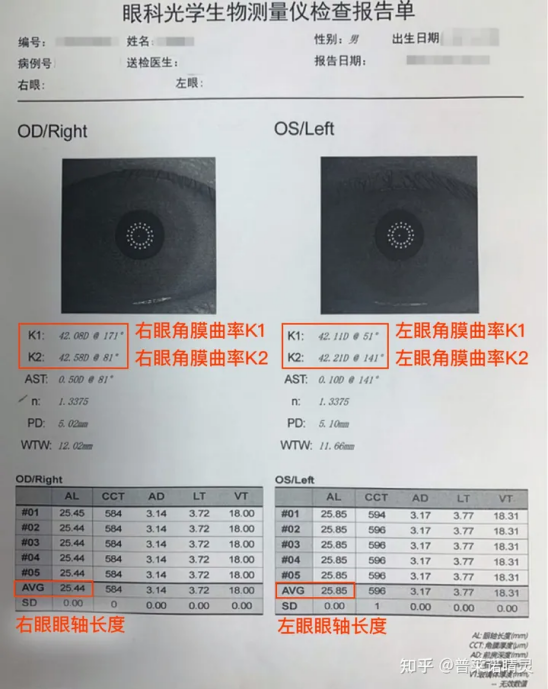 近视除了关注屈光度，还应关注眼轴！普莱诺睛灵3分钟教你读懂眼轴报告