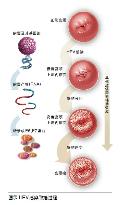 HPV的“天敌”，艾伯维人参多肽