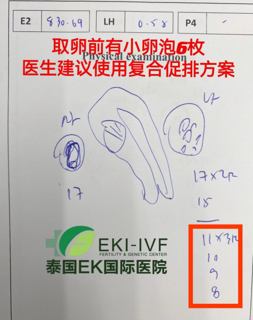 #泰国EK国际医院·大龄复合促排案例分享