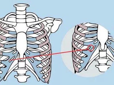  data-cke-saved-src=http___img2.soyoung.com_tieba_ios_post_20181024_8_e84b5c2567ff95a931273b27655e5726_570.jpg&refer=http___img2.soyoung src=http___img2.soyoung.com_tieba_ios_post_20181024_8_e84b5c2567ff95a931273b27655e5726_570.jpg&refer=http___img2.soyoung