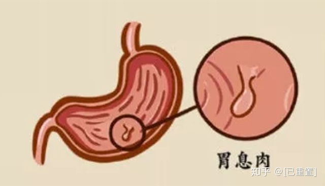  data-cke-saved-src=http-%2F%2Fpic1.zhimg.com%2Fv2-a49975f38dd445a9600c4e092cf2309c_b.jpg&refer=http-%2F%2Fpic1.zhimg src=http-%2F%2Fpic1.zhimg.com%2Fv2-a49975f38dd445a9600c4e092cf2309c_b.jpg&refer=http-%2F%2Fpic1.zhimg