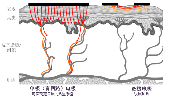 单级有回路
