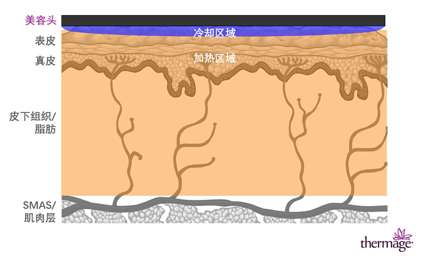 冷热交替