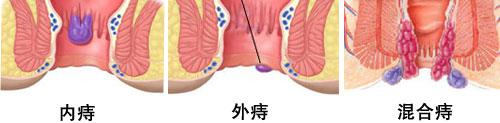 南充东大肛肠医院可靠吗?科室齐全技术一流