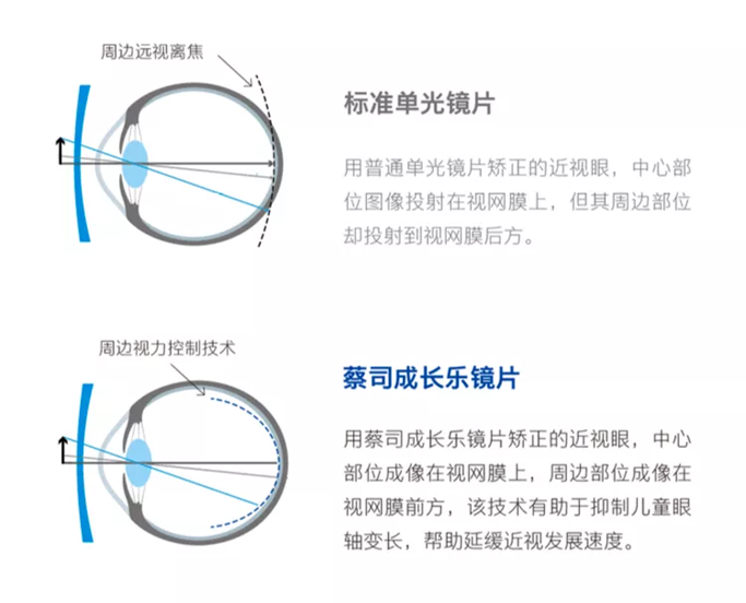 专注儿童近视眼镜，开学季！蔡司助力孩子近视防控