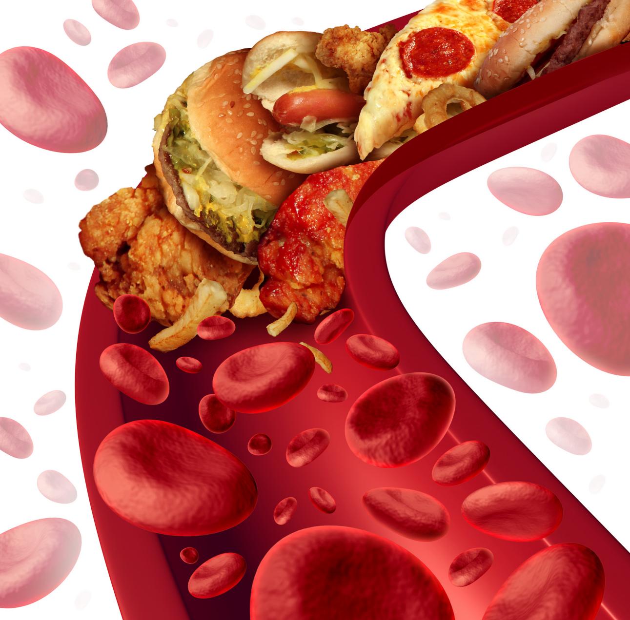 摄图网_300848074_banner_胆固醇阻断了动脉的医学,人体血管被健康的食物堵塞,如汉堡包油炸食品,健康风险的隐喻,节食营养问题如饮食脂肪(非企业商用)