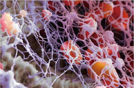 珍奥地龙让您远离“血栓” 珍奥地龙让您远离“血栓”