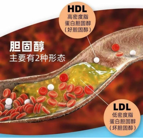 Lifespace提醒，要做健康代言人需区分好坏胆固醇