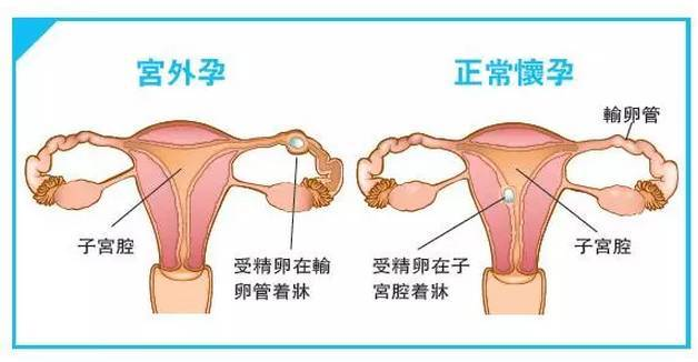 廊坊万福妇产医院科普健康知识保持初心做医疗