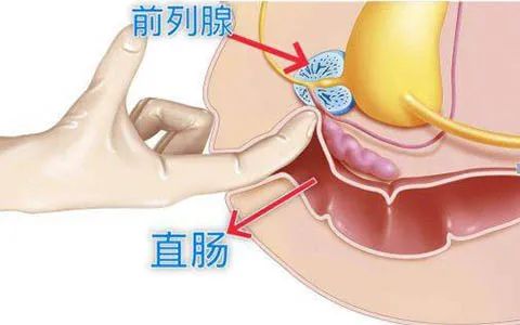 宁波看前列腺医院哪家好？宁波天一看男科口碑评价咋样？男性必读！前列腺健康自查指南↓