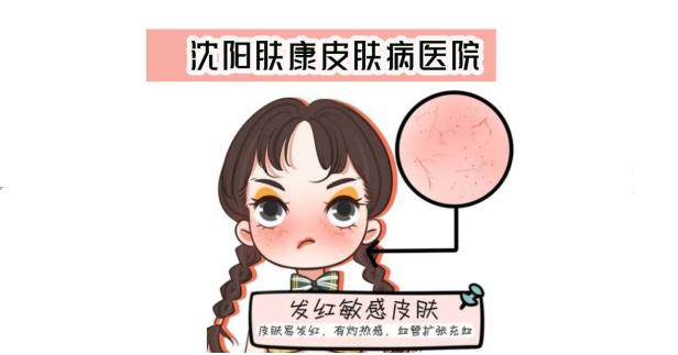 沈阳皮肤过敏去哪里看？