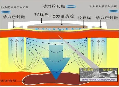 上海治疗肺脓肿最好的医院，上海太安中医科