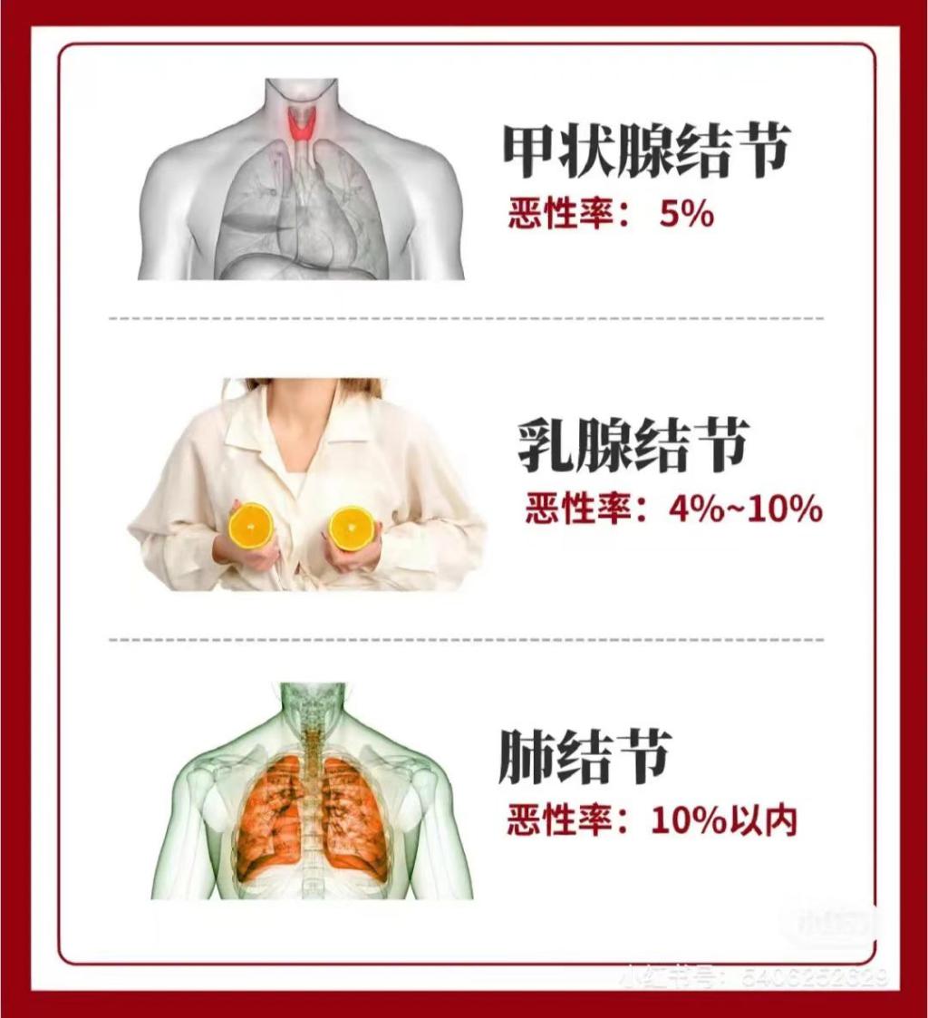 b42a14bc0d5b87d871368bfdb25352b