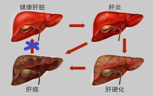 上海治疗肝癌哪家医院比较权威？上海太安医院医保定点