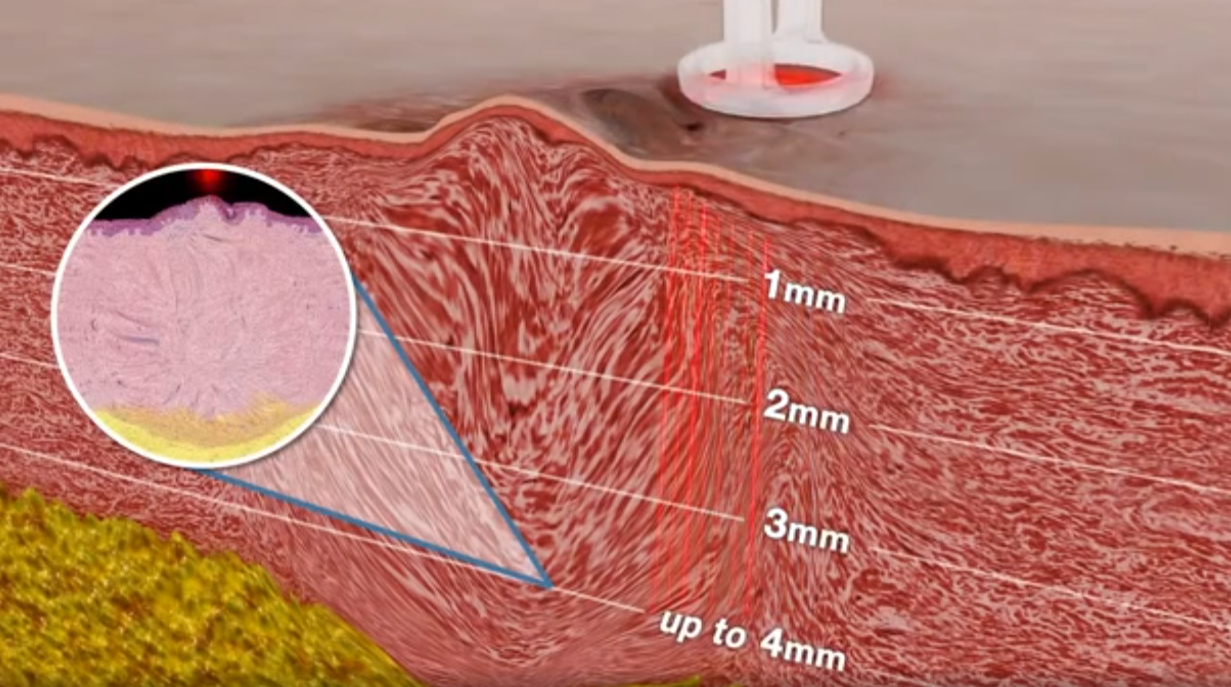 0ad1c27ebd8f0a1ee45b543f7d6d3a59