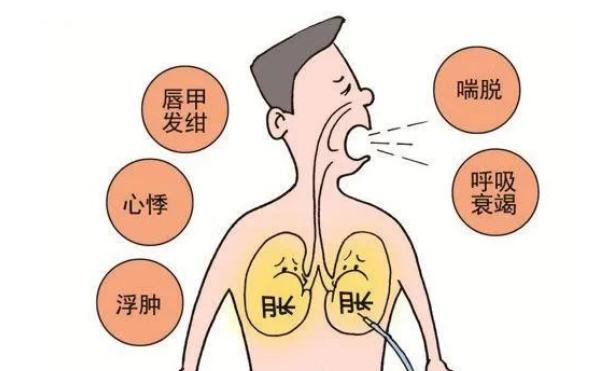 肺胀痛是什么原因？上海太安医院动力温控经皮给药治疗补肺益肾、降逆止喘！