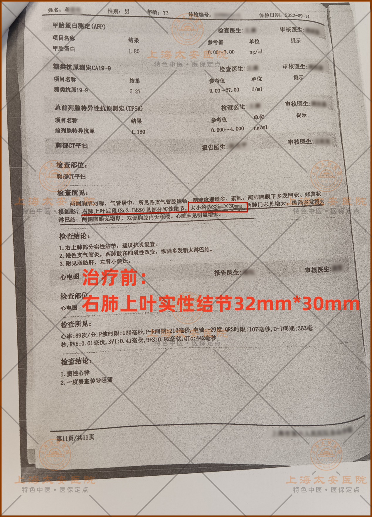 7ffeba98a51c451c10475e4105a4940