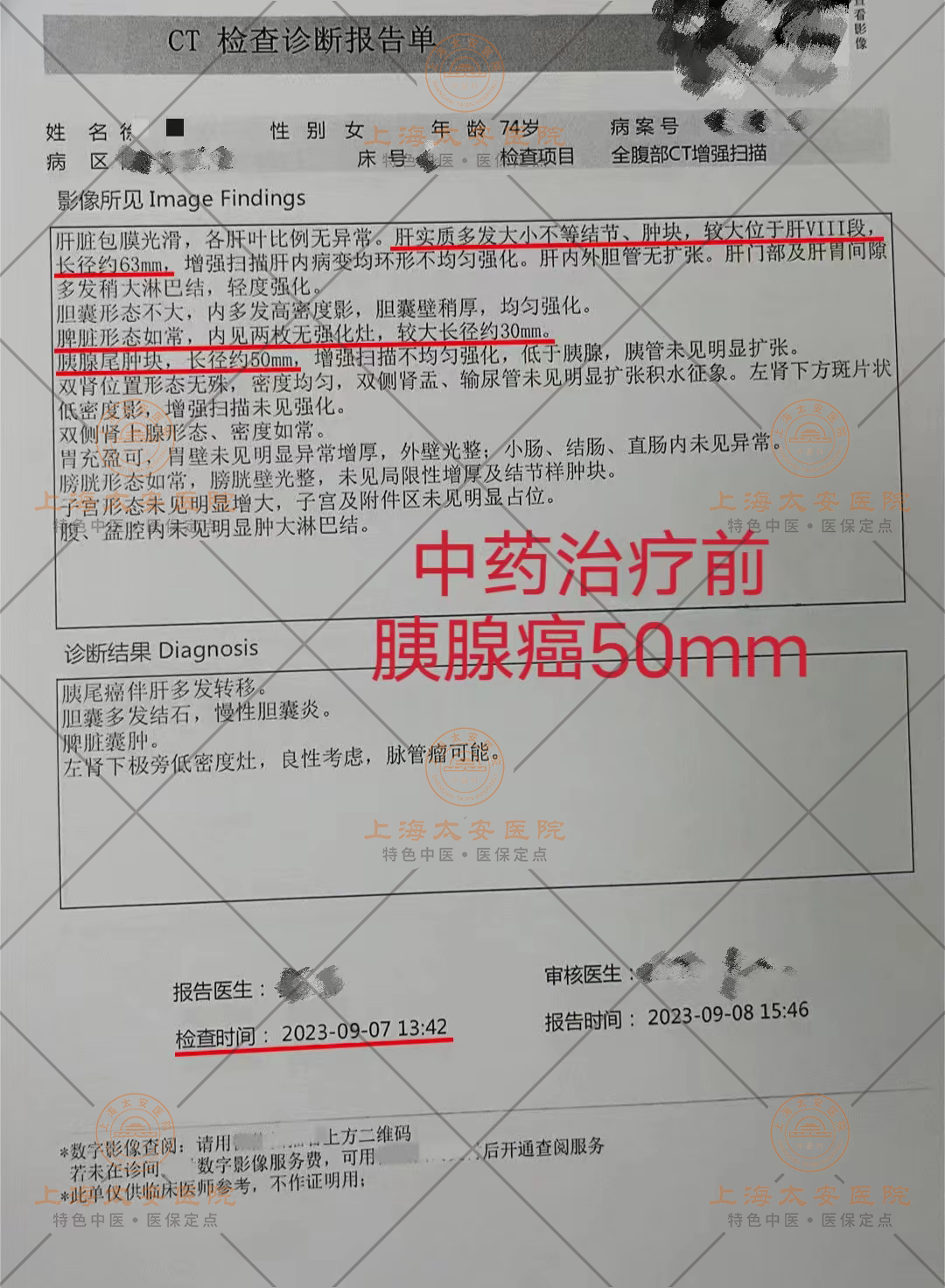 a2f092ef73aa1666d0ba5c51354a79b