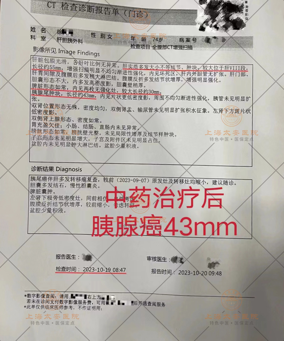 54ab5aeba9d40849112b1855dcd9427