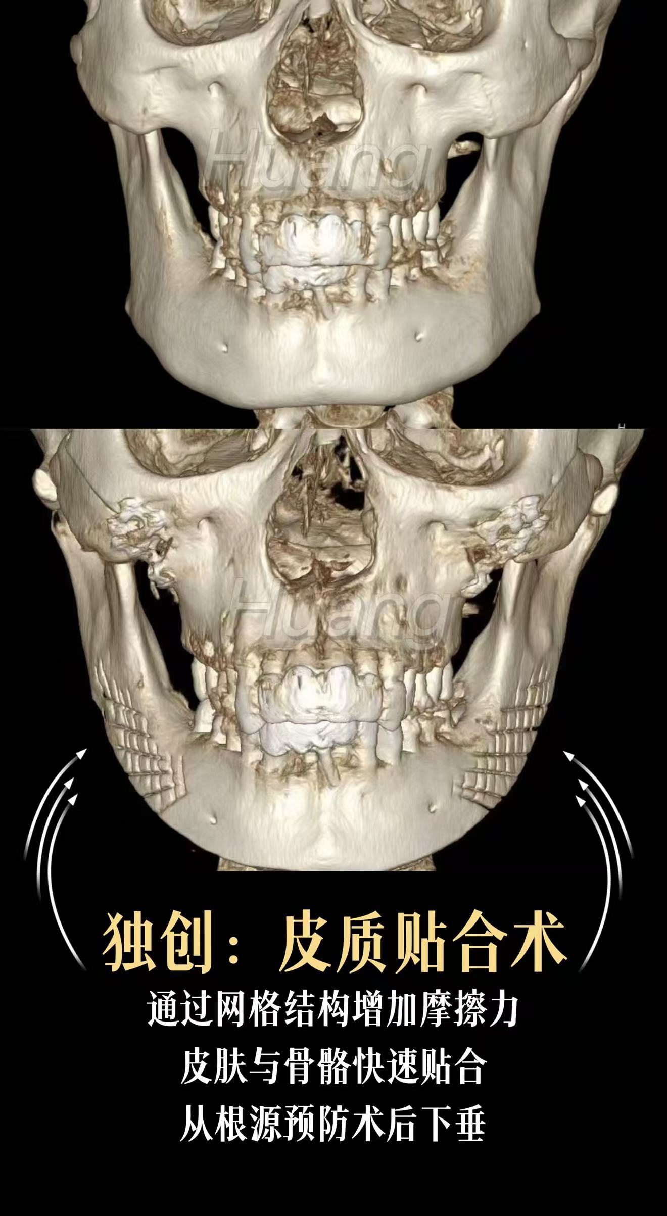 颌面磨骨:黄敬夏院长 以3D定制技术壁垒、数万例积淀与口碑,定义磨骨新标准 颌面磨骨:黄敬夏院长 以3D定制技术壁垒、数万例积淀与口碑,定义磨骨新标准